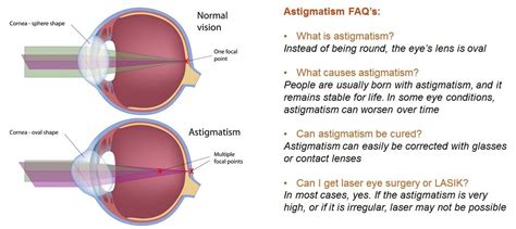 eye test results|A quick guide to interpreting eye test results .